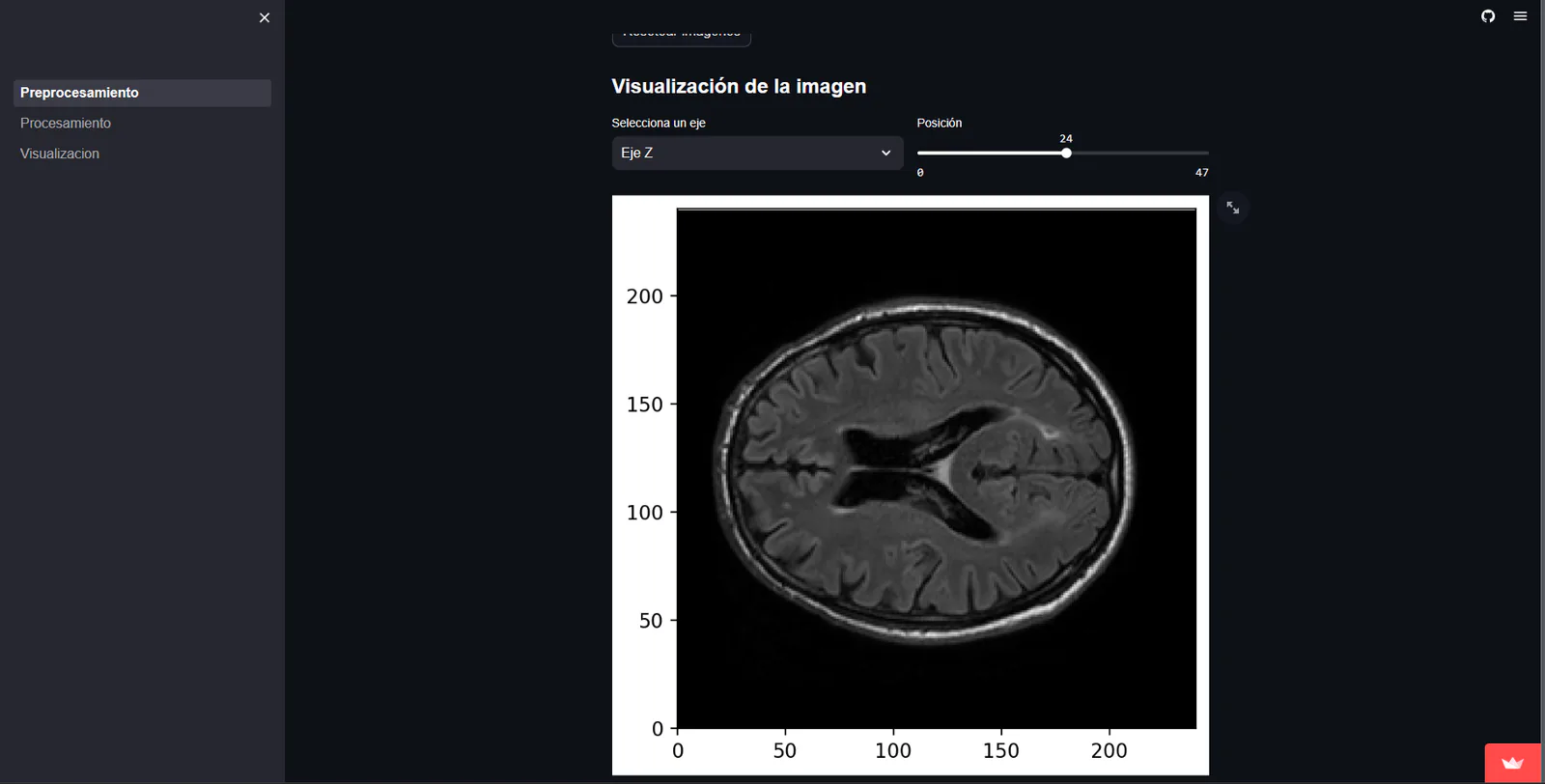 Streamlit interface displaying an axial medical image slice with axis and position controls